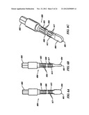 Anti-Rotation Fixation Element for Spinal Prostheses diagram and image