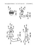 Anti-Rotation Fixation Element for Spinal Prostheses diagram and image