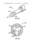 Anti-Rotation Fixation Element for Spinal Prostheses diagram and image