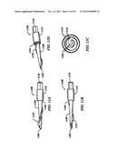 Anti-Rotation Fixation Element for Spinal Prostheses diagram and image