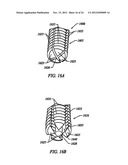 Anti-Rotation Fixation Element for Spinal Prostheses diagram and image