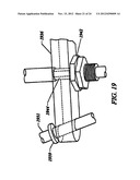 Anti-Rotation Fixation Element for Spinal Prostheses diagram and image