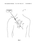 BATTERY FEEDTHROUGH FOR AN IMPLANTABLE MEDICAL DEVICE diagram and image