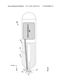 LEADLESS IMPLANTABLE MEDICAL DEVICE WITH OSMOTIC PUMP diagram and image