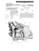 AV NODAL STIMULATION DURING ATRIAL TACHYARRHYTHMIA TO PREVENT     INAPPROPRIATE THERAPY DELIVERY diagram and image