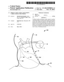 PHRENIC NERVE STIMULATION DURING CARDIAC REFRACTORY PERIOD diagram and image