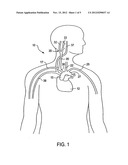 STIMULUS REGIMENS FOR CARDIOVASCULAR REFLEX CONTROL diagram and image