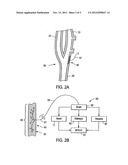 STIMULUS REGIMENS FOR CARDIOVASCULAR REFLEX CONTROL diagram and image