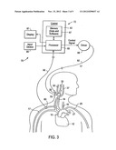 STIMULUS REGIMENS FOR CARDIOVASCULAR REFLEX CONTROL diagram and image