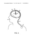 MANAGEMENT OF STIMULATION SAFETY LIMITS IN A NEUROSTIMULATION SYSTEM diagram and image