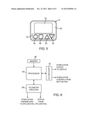 NEUROSTIMULATION SYSTEM WITH ON-EFFECTOR PROGRAMMER CONTROL diagram and image