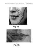 Method For Achieving Facial Toning Using Selectively Applied Galvanic     Current diagram and image