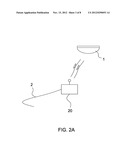 RENAL NERVE STIMULATION LEAD, DELIVERY SYSTEM, AND METHOD diagram and image