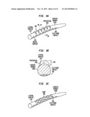 DRUG RETAINING SURFACE FEATURES IN AN IMPLANTABLE MEDICAL DEVICE diagram and image