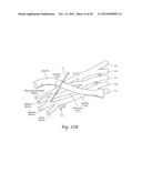 SYSTEMS AND METHODS TO PLACE ONE OR MORE LEADS IN TISSUE TO ELECTRICALLY     STIMULATE NERVES TO TREAT PAIN diagram and image