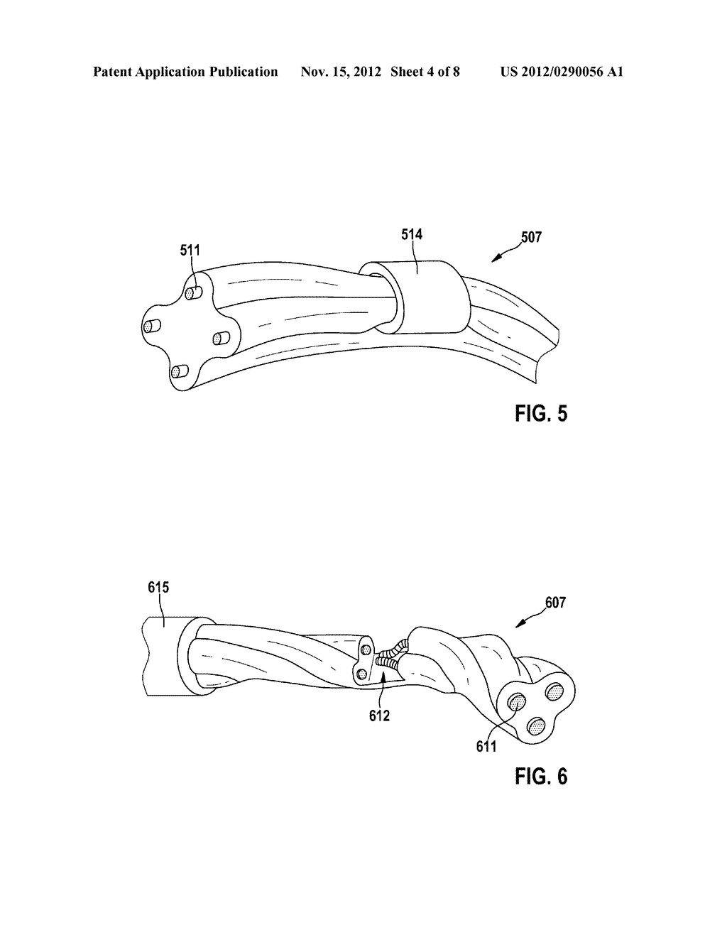 Implantable Medical Lead - diagram, schematic, and image 05