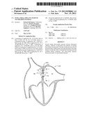 INTRA-ATRIAL IMPLANTS MADE OF NON-BRAIDED MATERIAL diagram and image