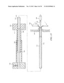 INTRA-ATRIAL IMPLANTS MADE OF NON-BRAIDED MATERIAL diagram and image