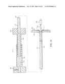 INTRA-ATRIAL IMPLANTS MADE OF NON-BRAIDED MATERIAL diagram and image