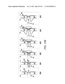 INTRA-ATRIAL IMPLANTS MADE OF NON-BRAIDED MATERIAL diagram and image