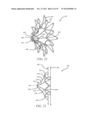 INTRA-ATRIAL IMPLANTS MADE OF NON-BRAIDED MATERIAL diagram and image