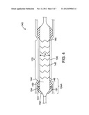 Method of Increasing Stent Retention of Bioabsorbable Scaffolding with a     Sheath diagram and image