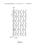 Method of Increasing Stent Retention of Bioabsorbable Scaffolding with a     Sheath diagram and image