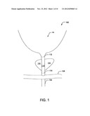 Pre-Positioned Anastomosis Device and Related Methods of Use diagram and image