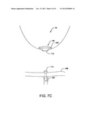 Pre-Positioned Anastomosis Device and Related Methods of Use diagram and image