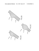 VASCULAR REMODELING DEVICE diagram and image