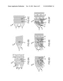 VASCULAR REMODELING DEVICE diagram and image