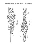 VASCULAR REMODELING DEVICE diagram and image