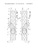 STEERABLE ILIAC BRANCH DEVICE diagram and image