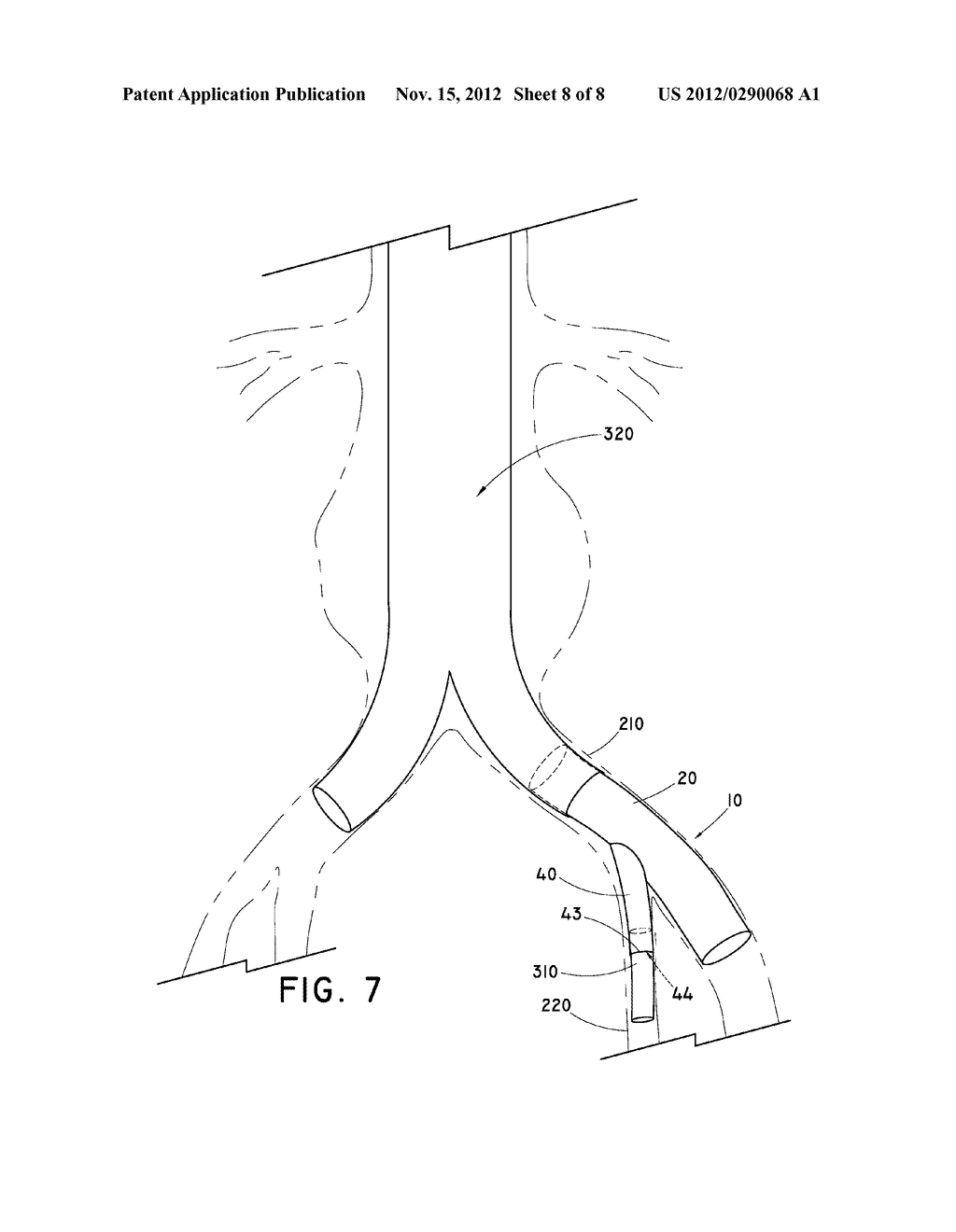 STEERABLE ILIAC BRANCH DEVICE - diagram, schematic, and image 09