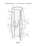 PARAPLEGIA PREVENTION VALVE FOR STENT GRAFTS diagram and image