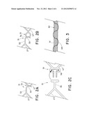 EMERGENCY VASCULAR REPAIR PROSTHESIS diagram and image