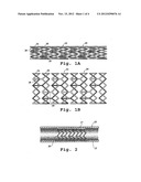 DRUG-DELIVERY ENDOVASCULAR STENT AND METHOD FOR TREATING RESTENOSIS diagram and image