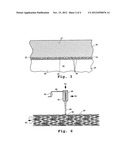 DRUG-DELIVERY ENDOVASCULAR STENT AND METHOD FOR TREATING RESTENOSIS diagram and image