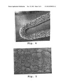 DRUG-DELIVERY ENDOVASCULAR STENT AND METHOD FOR TREATING RESTENOSIS diagram and image