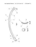 TISSUE RESTRAINING DEVICES AND METHODS OF USE diagram and image