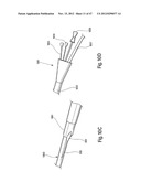 TISSUE RESTRAINING DEVICES AND METHODS OF USE diagram and image