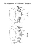 TISSUE RESTRAINING DEVICES AND METHODS OF USE diagram and image