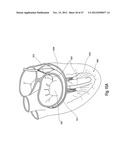 TISSUE RESTRAINING DEVICES AND METHODS OF USE diagram and image