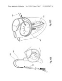 TISSUE RESTRAINING DEVICES AND METHODS OF USE diagram and image