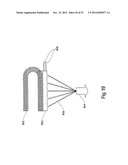 TISSUE RESTRAINING DEVICES AND METHODS OF USE diagram and image