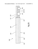 TISSUE RESTRAINING DEVICES AND METHODS OF USE diagram and image