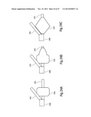 TISSUE RESTRAINING DEVICES AND METHODS OF USE diagram and image