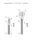 TISSUE RESTRAINING DEVICES AND METHODS OF USE diagram and image