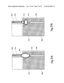 TISSUE RESTRAINING DEVICES AND METHODS OF USE diagram and image