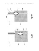 TISSUE RESTRAINING DEVICES AND METHODS OF USE diagram and image